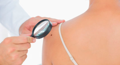 Dermatologie | Hautarzt in Zürich