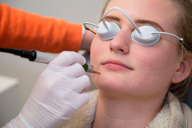 Lasertherapie  Laserbehandlung  Hautarzt in Zürich